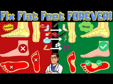 How to FIX Flat Feet Pain FOREVER [Overpronation vs. Supination]