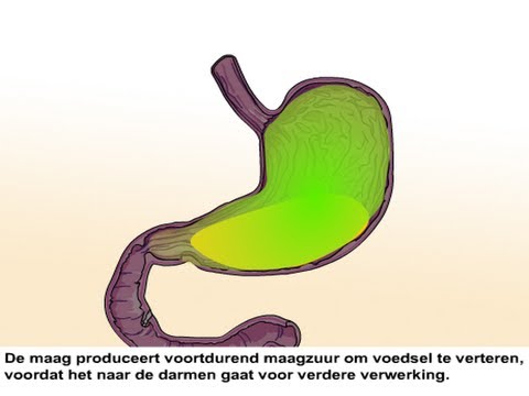 Maagklachten - Oorzaak en symptomen