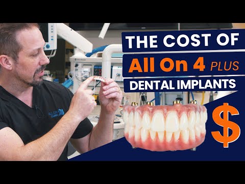 True Cost of All On 4 Plus® Dental Implants