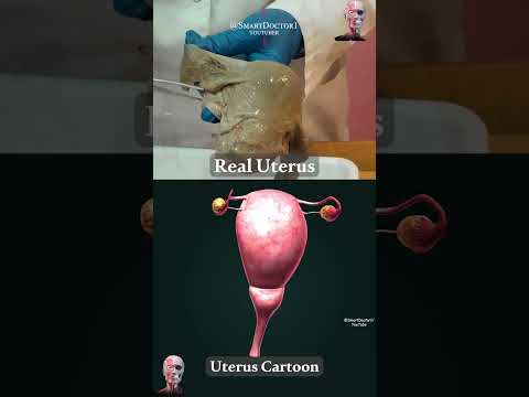 Cartoon uterus. #shorts #viral