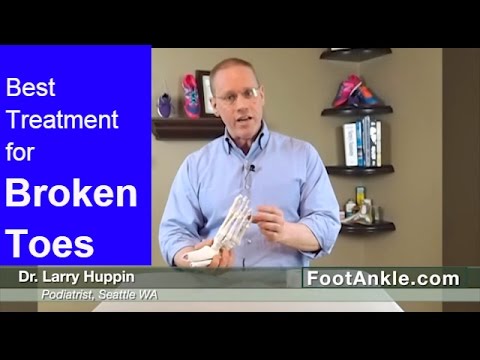 What is the Best Treatment for a Broken Toe? (and why you should NEVER buddy tape a stubbed toe)