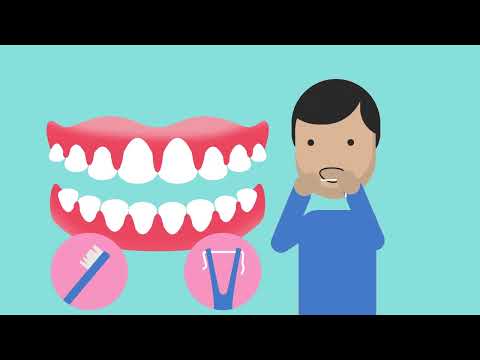 Explaining gum disease